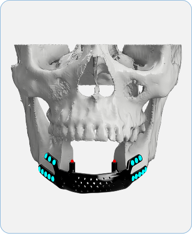 Segmentation & Design Simulation
