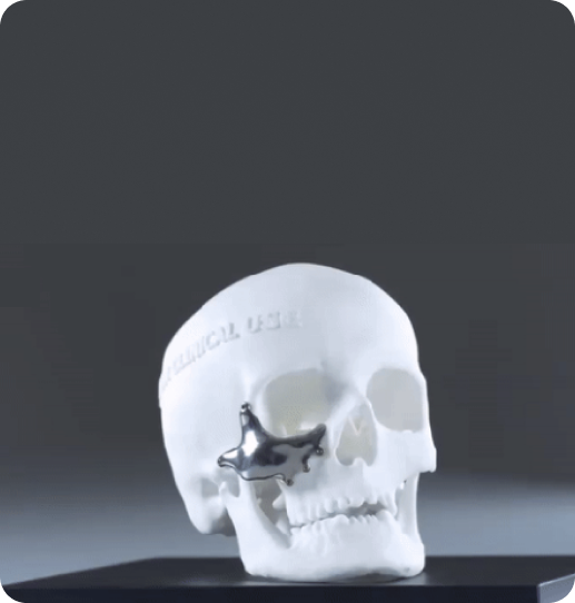 Patient Specific Implants