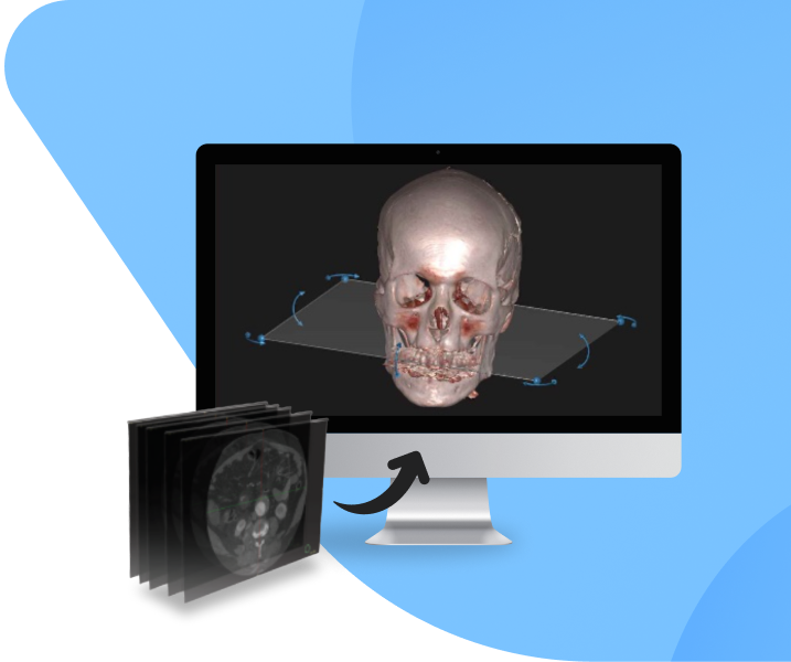 Medical Image Segmentation