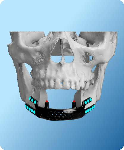 Overview of Oral and Maxillofacial Surgery defects