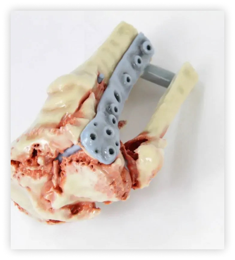 Regraft Bonerip - Bone like printed training models