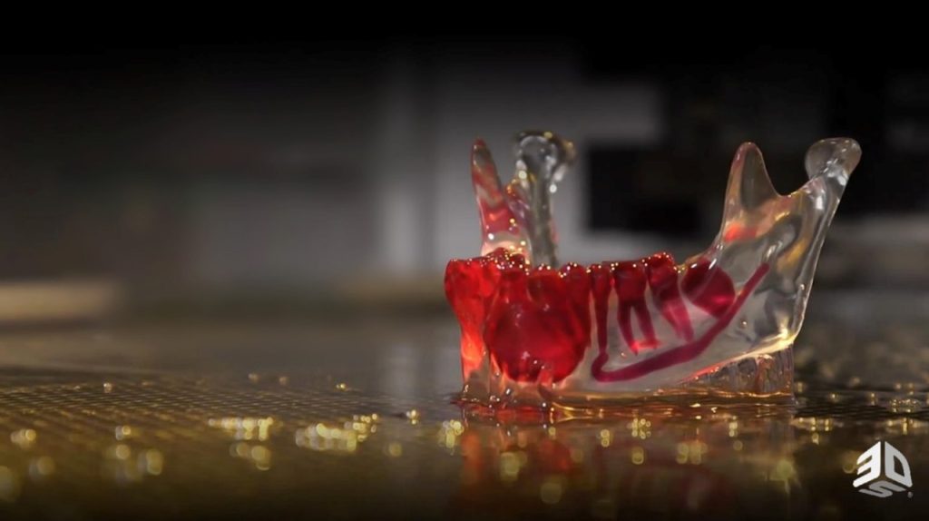 Regraft Bonerip -Transparent 3D Printed Models