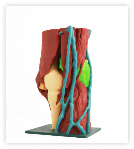 Regraft Bonerip - Coloured 3D Printed material