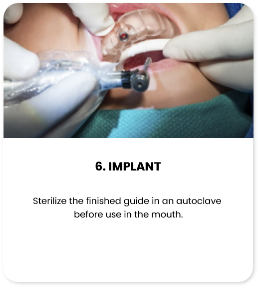 /images/regraft-digilumin/implant.png