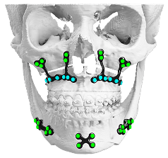 VSP Skull Model Overview