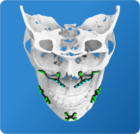3D Skull Model on blue background