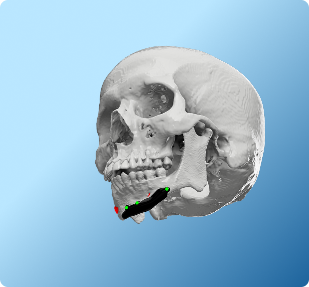 Facial Bone Overview