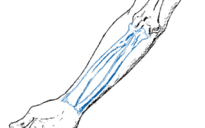 Mandible Reconstruction