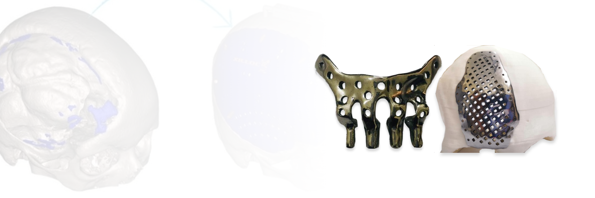 Healthcare 3D Printed Products