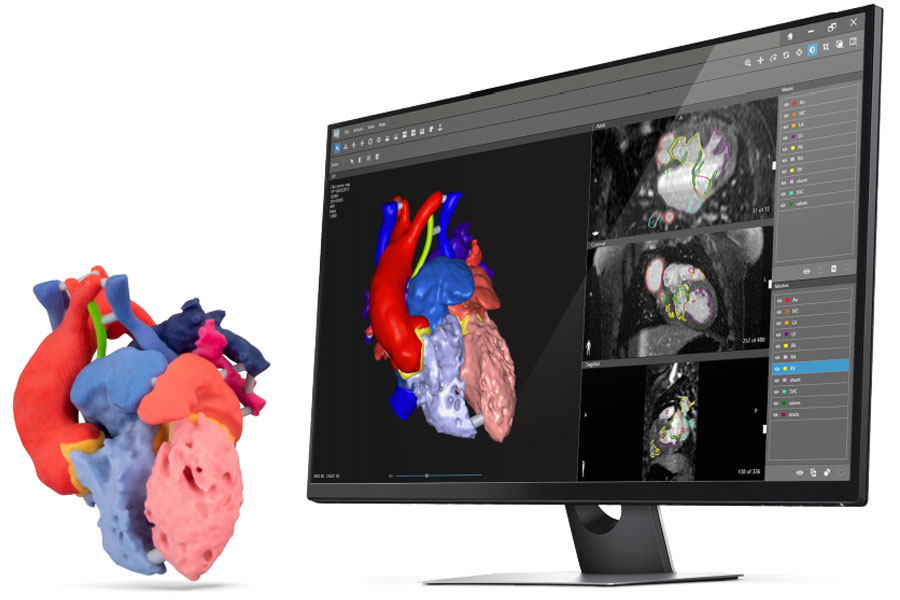 D2P – Bone, Vascular, Teeth