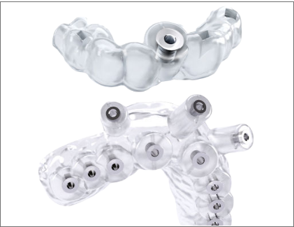 Dental Surgical Guide