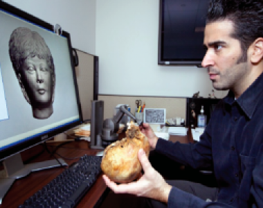 OralCase Study on replacing Cancer infected Nose with Artificial Nose Prosthesis