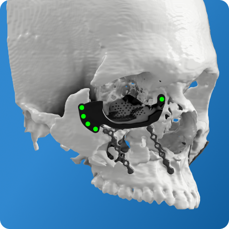 Polyetheretherketone PEEK filament spools