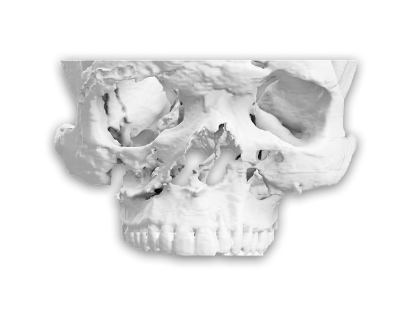 Indications For Patient