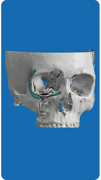 Materials In 3D Printing