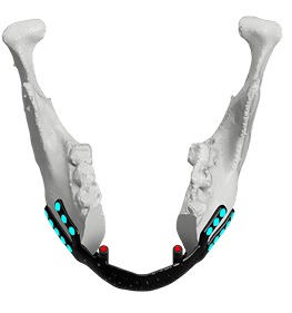 Regraft RRTC - Tumors