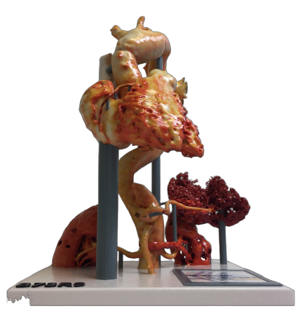 ReGraft Bonerip anatomical model