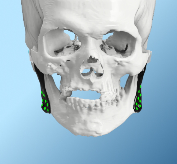 Advantages of a Digital Workflow