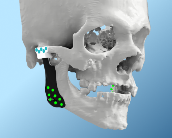 Advantages of a Digital Workflow