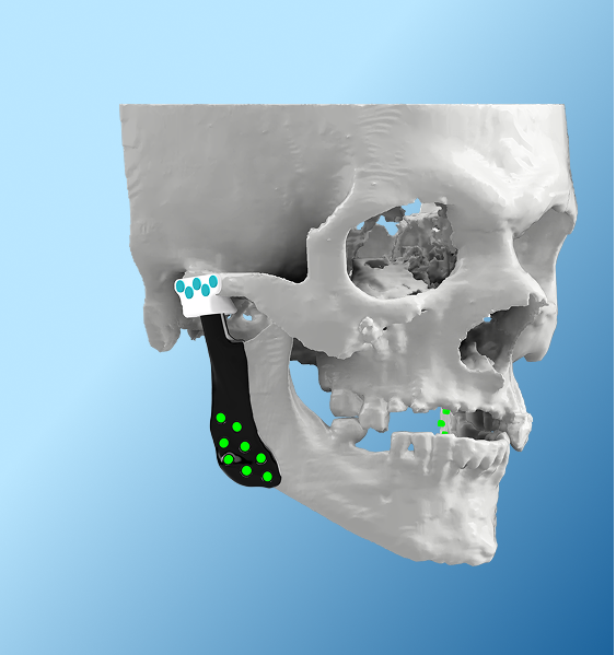 Overview of Temporomandibular Joint