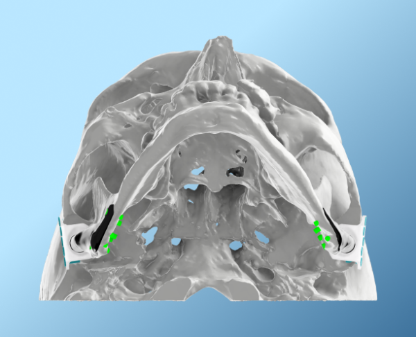 Advantages of a Digital Workflow