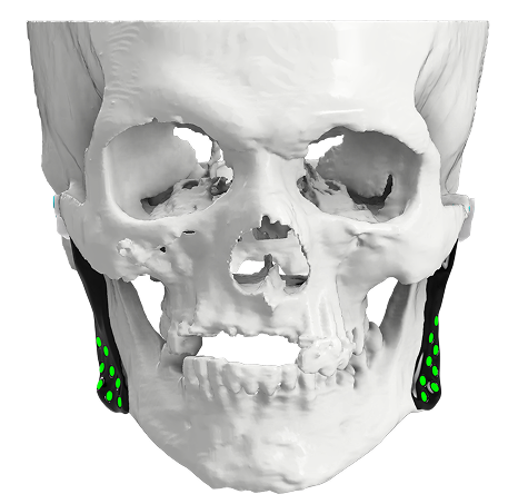 Temporomandibular Joint