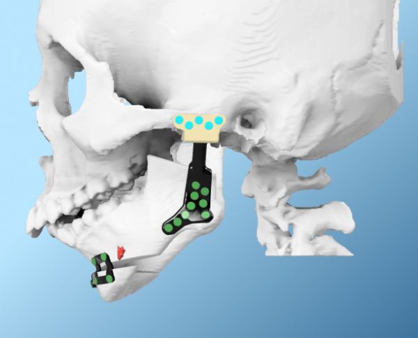Advantages of a Digital Workflow